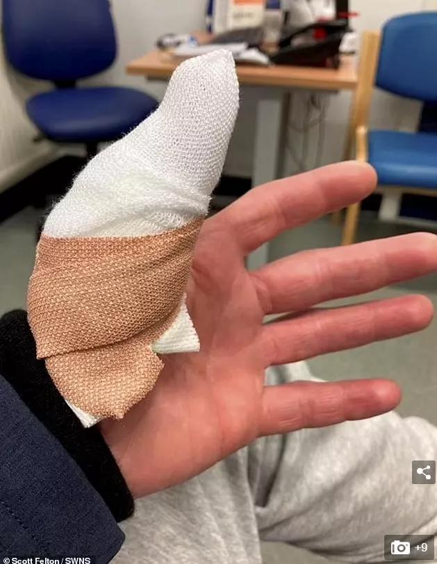 松鼠发狂咬人,松鼠疯狂咬人