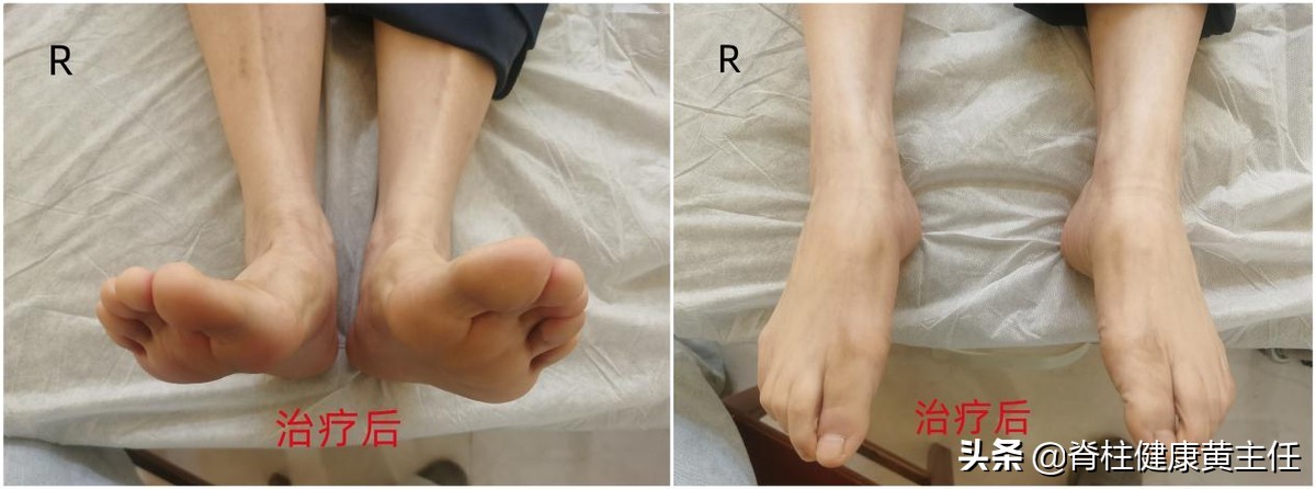 大体重造成的踝关节损伤怎么治疗,踝关节韧带损伤疼痛怎么治疗