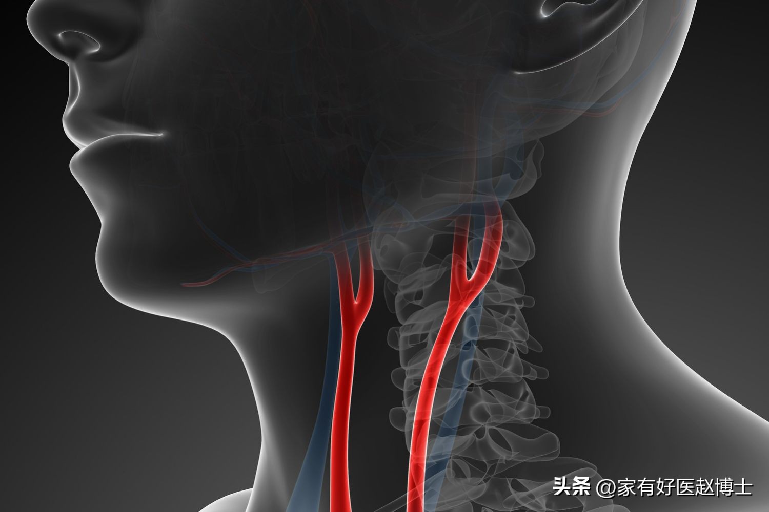 有动脉斑块必须要吃阿司匹林多久,有颈动脉斑块吃阿司匹林可以吗