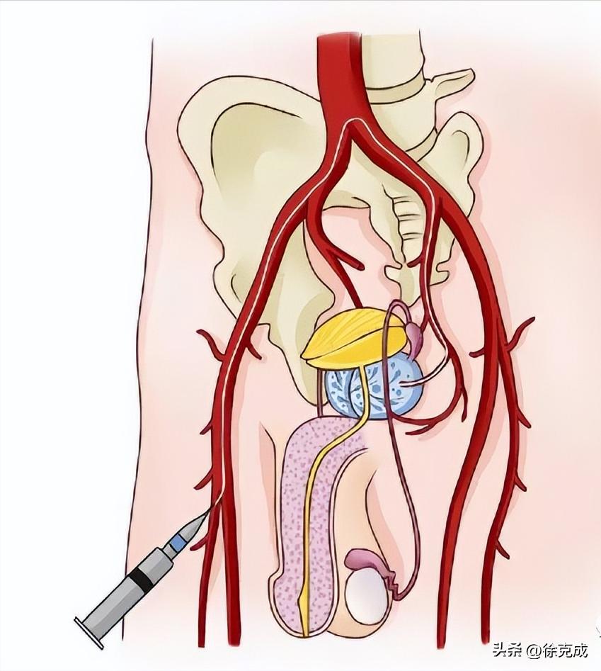 徐克成教授中医,肿瘤专家徐克成教授