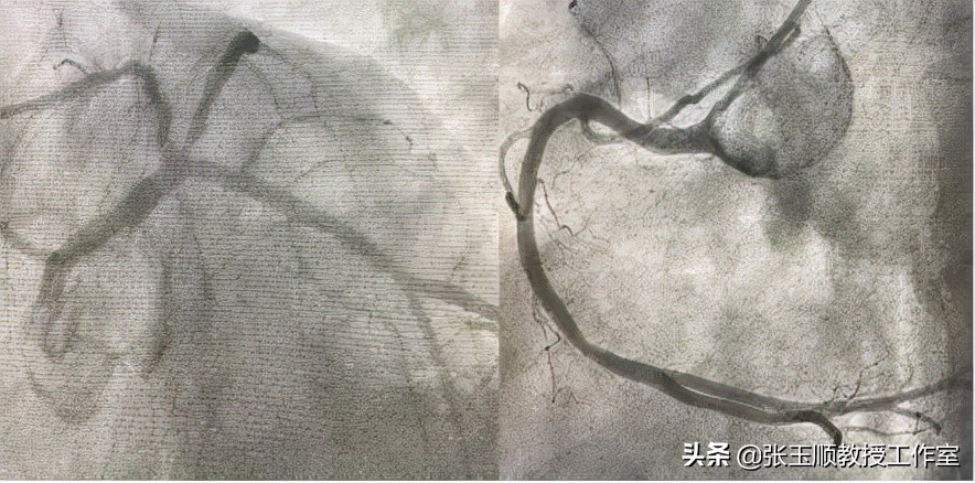 咳嗽不停该咋办导致晕厥,反复咳嗽一个月了是什么原因