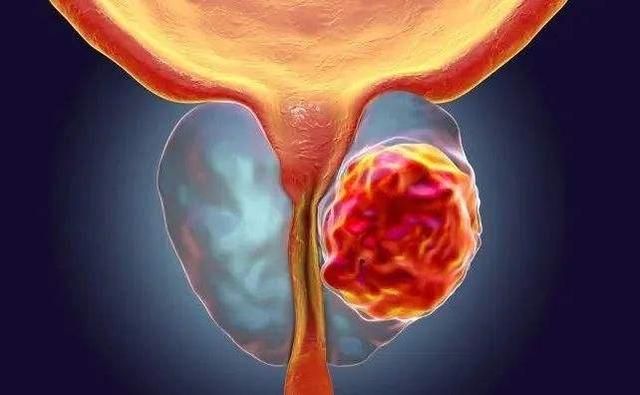 告诉爸妈这5种老年病不需要治疗,7种病属于老年病不用过度治疗