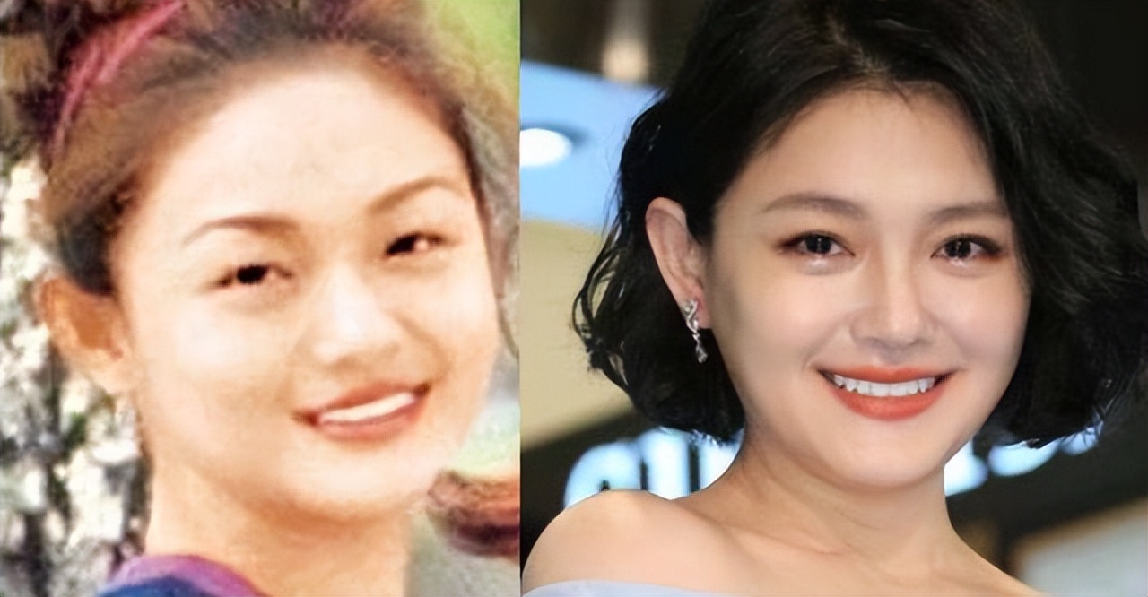 明星自曝瘦脸针,经常打瘦脸针的女明星