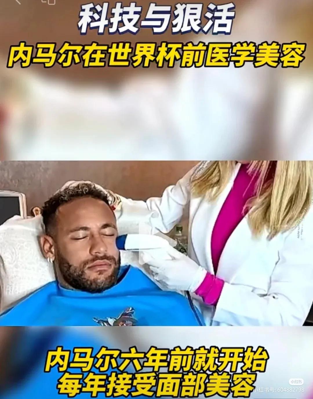 c罗内马尔在一个队吗,内马尔医美项目全过程