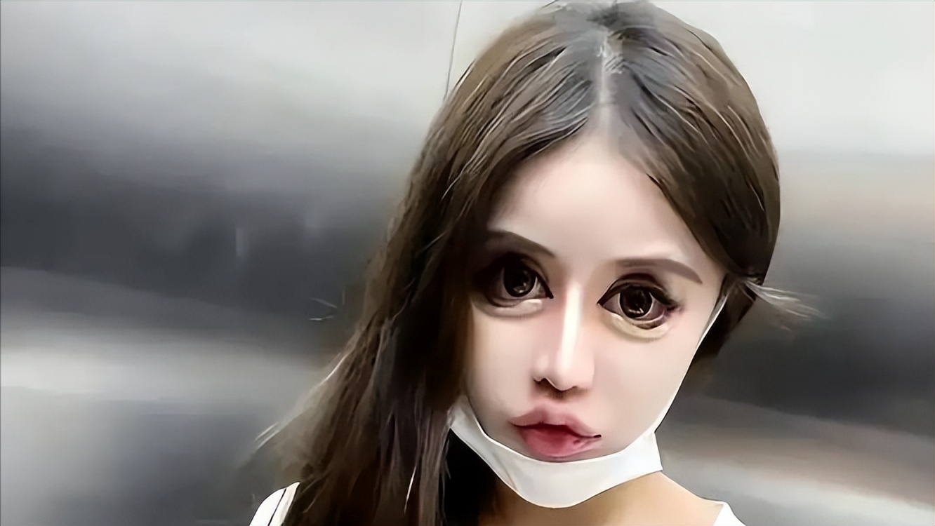 整容狂人整容100多次,整容狂魔手术200次