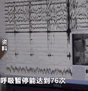 打呼不是病打起来要人命,打呼是一种病吗怎么治