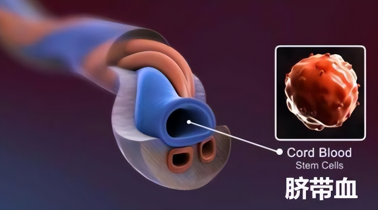 给新生儿剪脐带宝宝会疼吗,新生儿怎么剪脐带肚脐好看