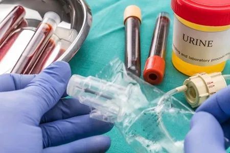 痛风反复发作教你一招让痛风缓解,痛风反复发作别乱治试试这个方法