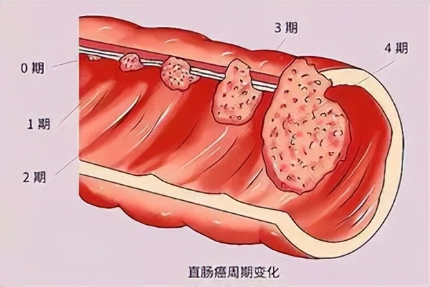 便秘严重喝香油管用吗,香蕉香油治疗便秘