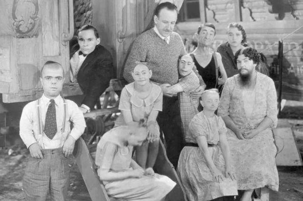 英国连体姐妹因流感去世,英国连体姐妹去世