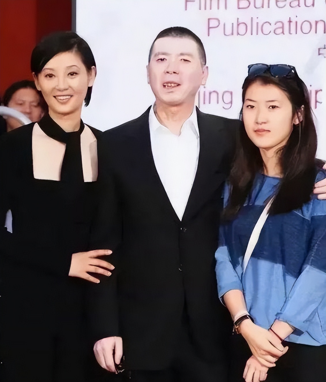 白癜风冯小刚症状,冯小刚谈不治白癜风的原因