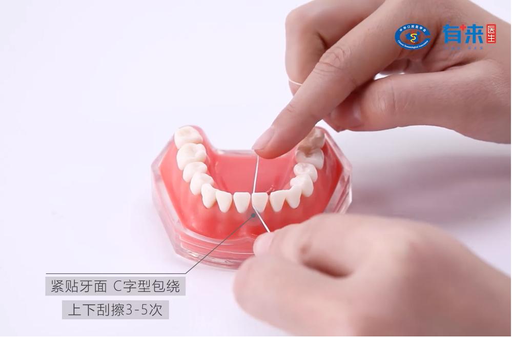 我们的目标是没有蛀牙出处,有没有保护牙齿不蛀牙的办法