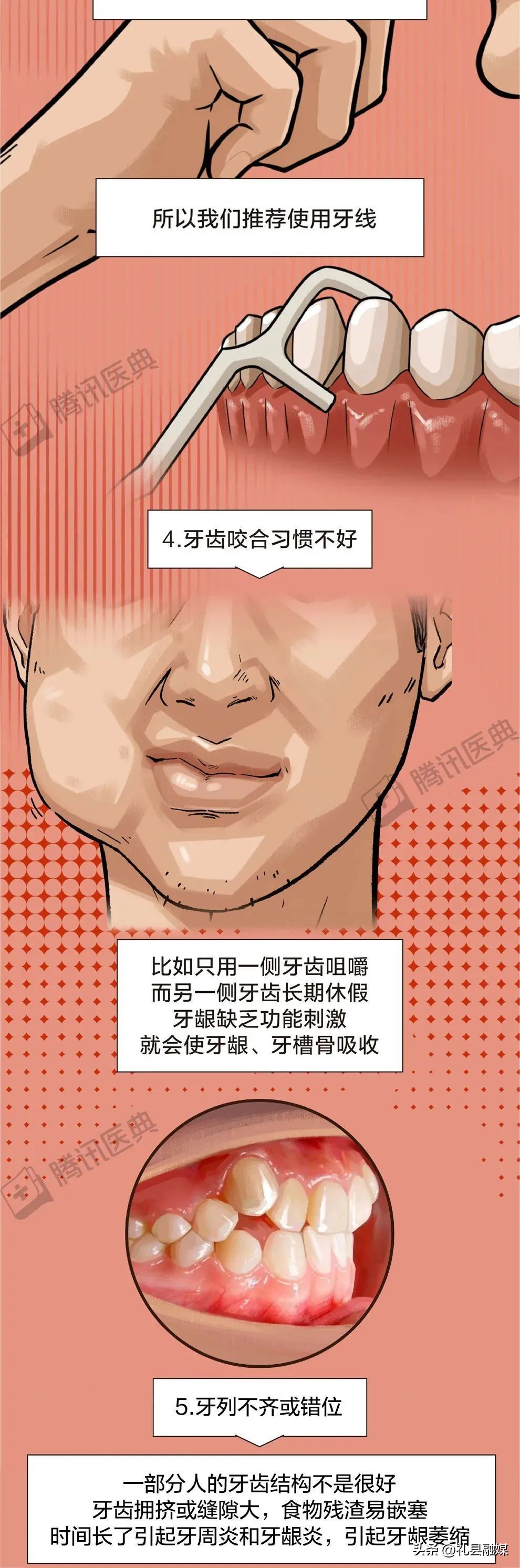 牙缝隙大吃菜就塞牙怎么修复,牙齿吃菜老塞牙怎么办