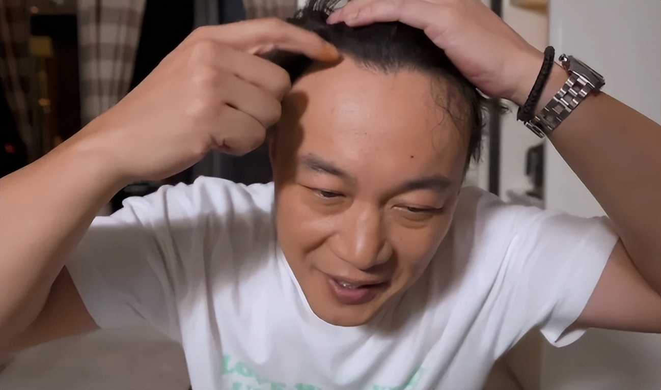 明星沙溢脱发撒娇,沙溢脱发搞笑