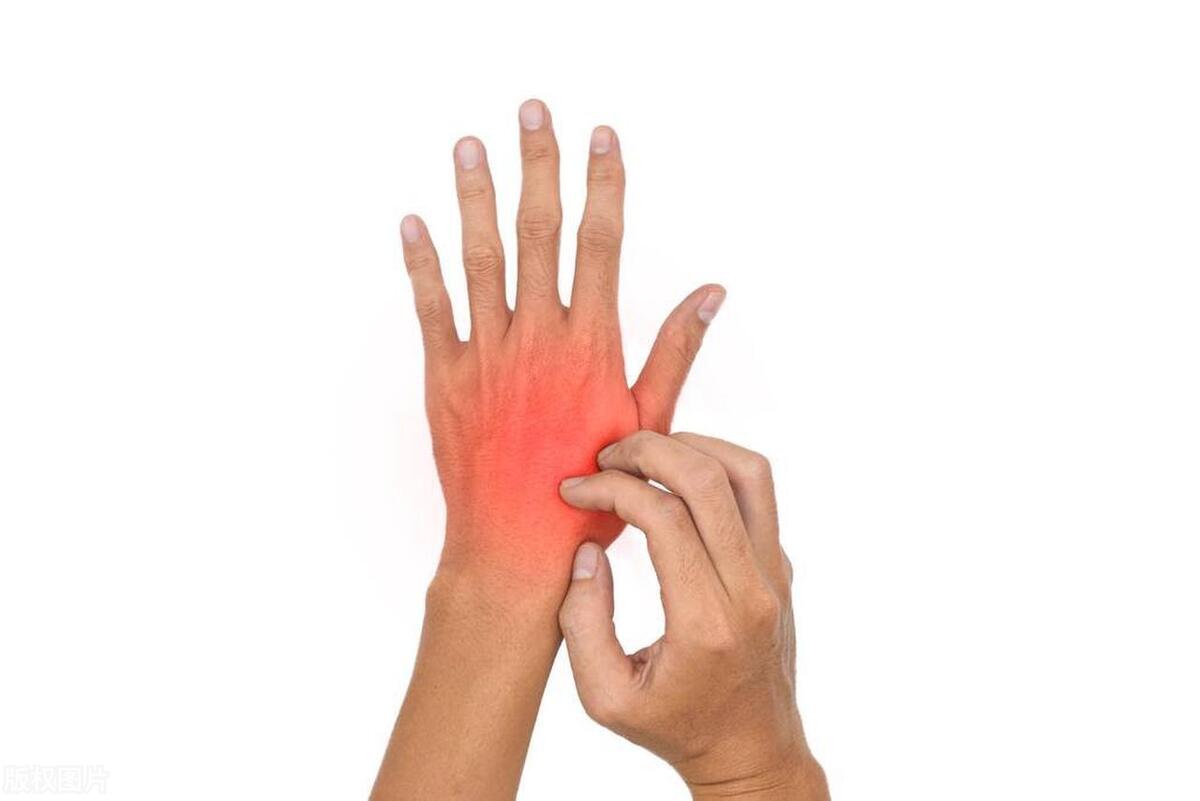 万能止痒特效药外用药,全身湿疹止痒神器