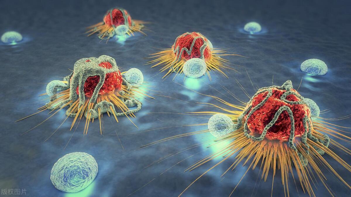 细胞瘤最好的治疗方法,除了遗传什么原因会掉头发