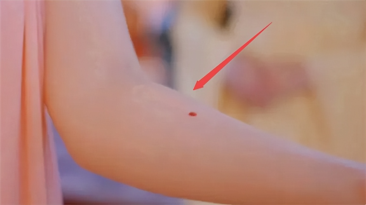 守宫砂真的能鉴别女子清白吗,守宫砂为什么能验证女人的贞操