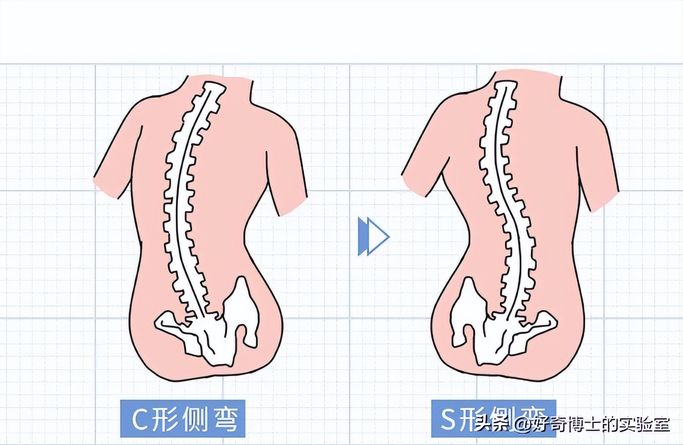 哪些姿势对腰部有损伤,哪种姿势对腰的伤害大