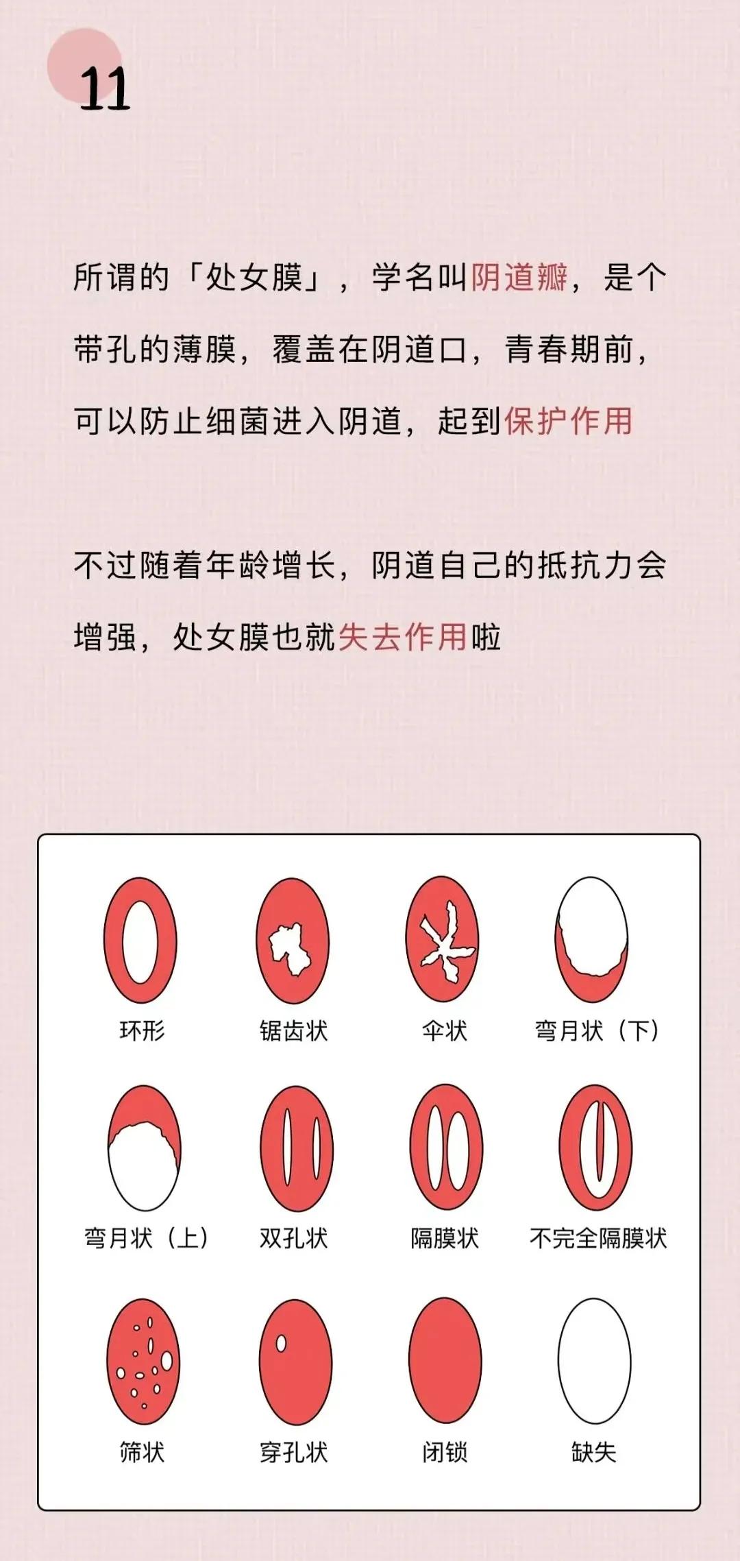 女生要知道的十个妇科常识,女生必须知道的7条妇科常识