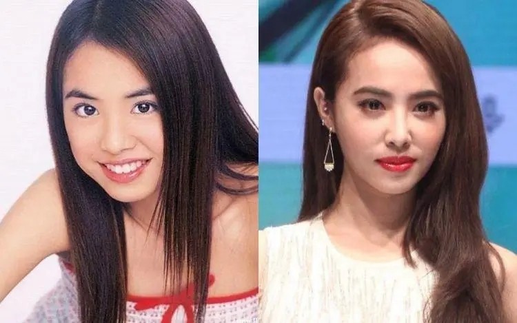 连女明星都喜爱的轮廓固定，究竟有何魅力？