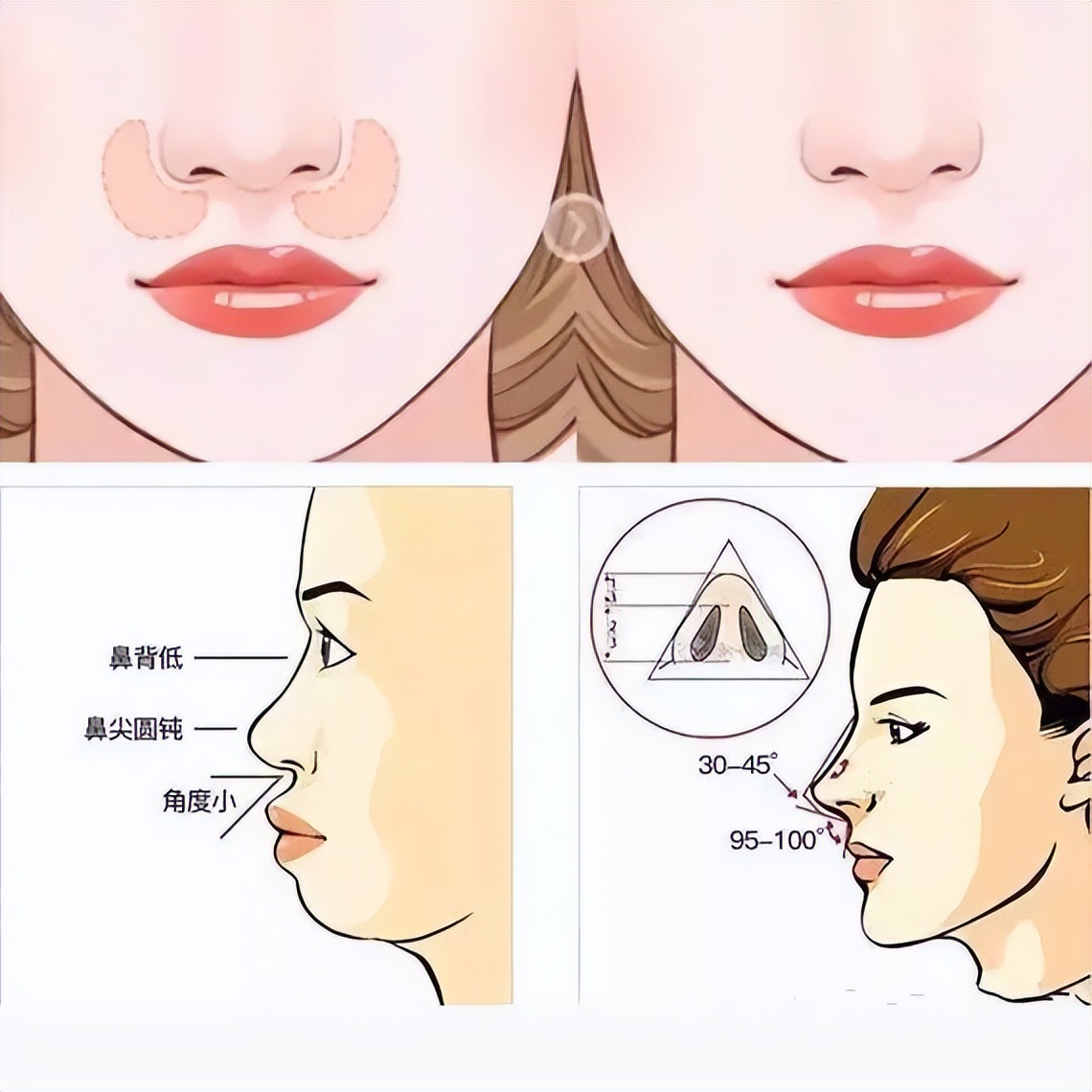 上海九院韦敏轮廓做得好吗,九院韦敏磨骨好吗