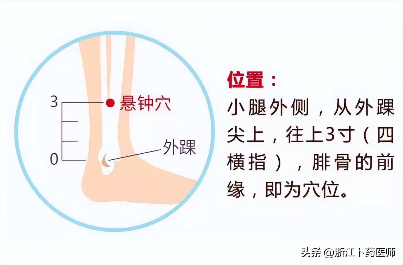 血脂高眼睑斑图片,眼睛血脂高引起的斑点如何消除