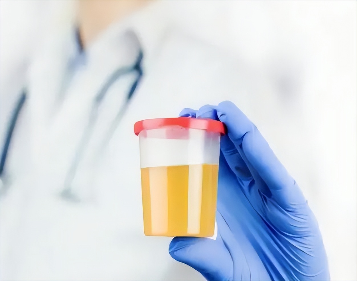 寿命长短看小便,排尿时有哪四种情况会判断寿命