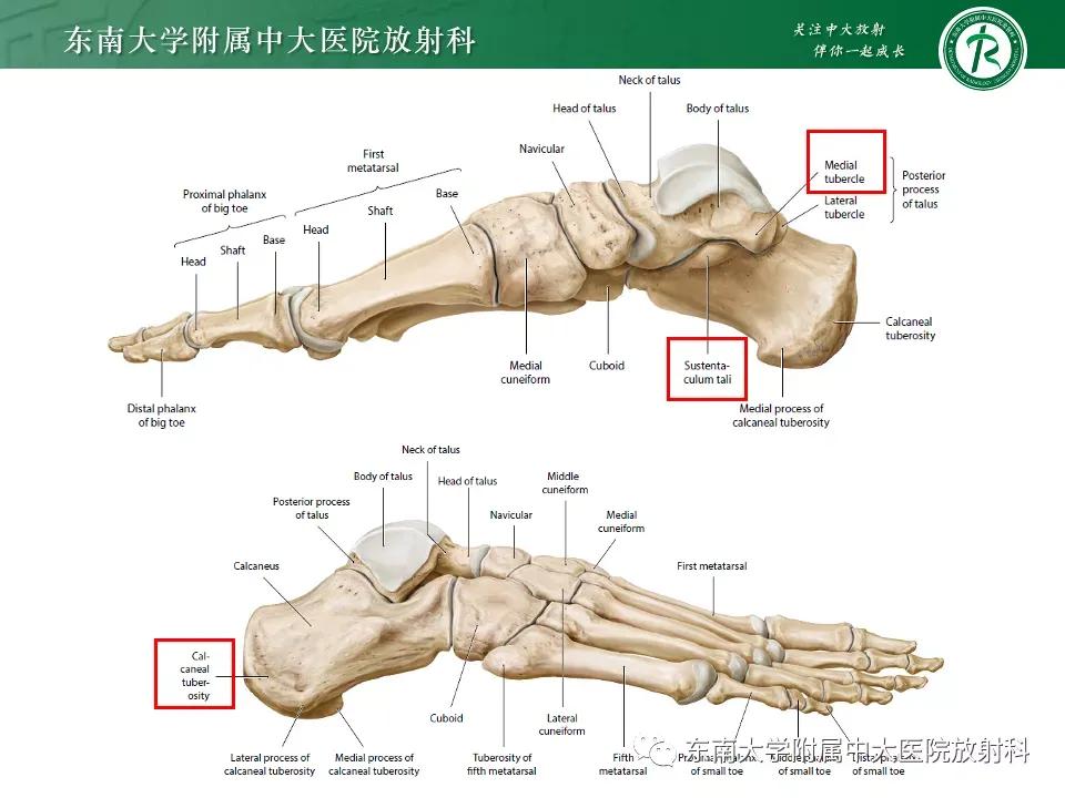 好文分享-《肌骨系统疾病——副舟骨综合征》