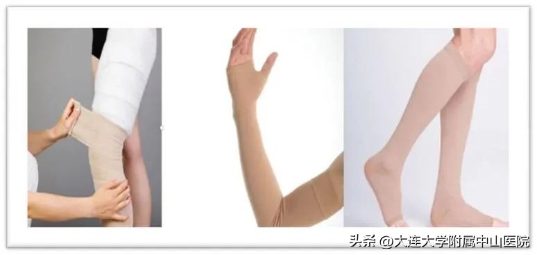 淋巴清扫后水肿怎么治疗可以康复,腋窝淋巴清扫后腋窝水肿处理方法