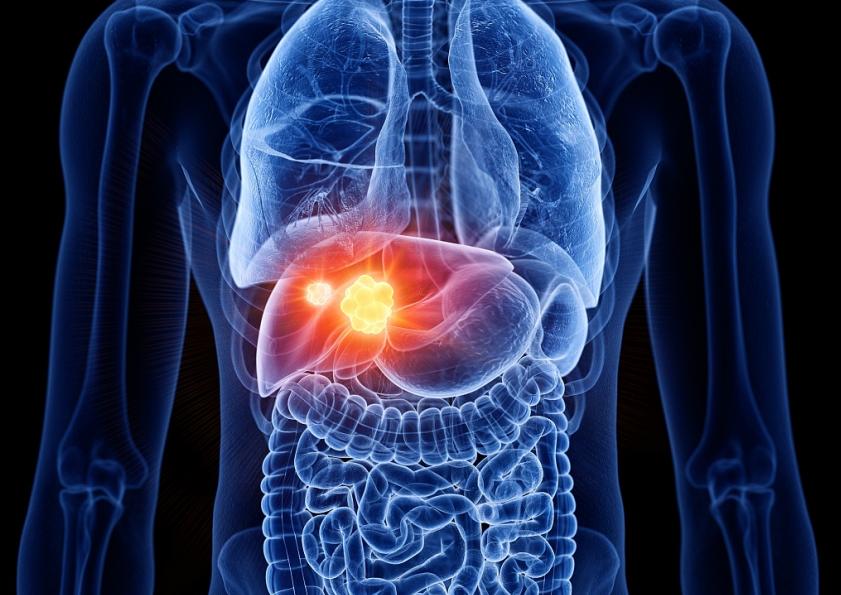 睡醒了全身酸痛无力没精神怎么办,全身酸痛无力整天睡不醒怎么回事