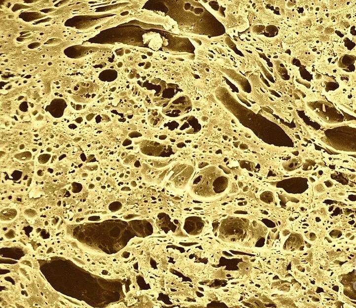 手指在显微镜下太恐怖了,显微镜下的恐怖世界蝎子