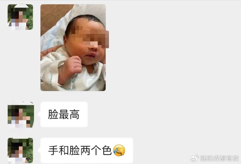 新生宝宝变成“小黄人”了怎么办?这件事一定要做