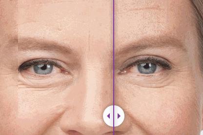 抗皱a醇眼霜良心推荐,平价去皱纹的a醇眼霜哪个效果好