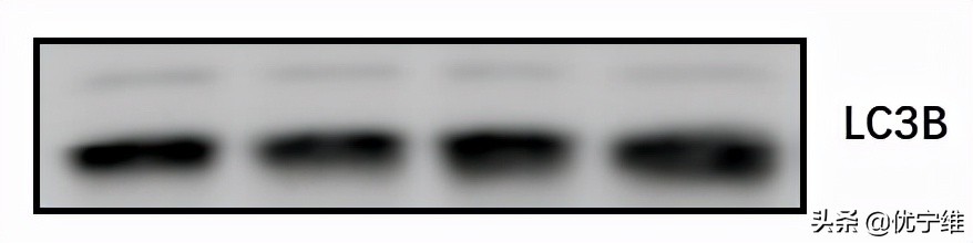 lc3自噬标记物,lc300有哪些隐藏功能
