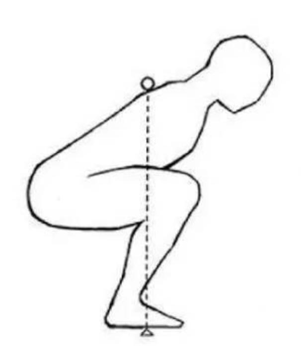 痔疮手术笔记怎么写,痔疮手术换药患者自述