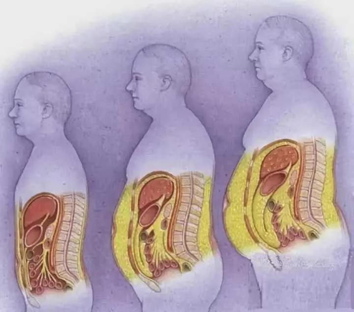 内脏脂肪高是不是特别容易胖,人胖了对身体器官有什么危害