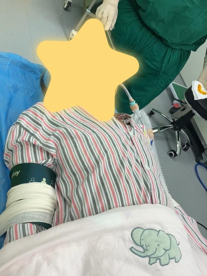 整形隆鼻手术,隆鼻整形全麻手术全过程