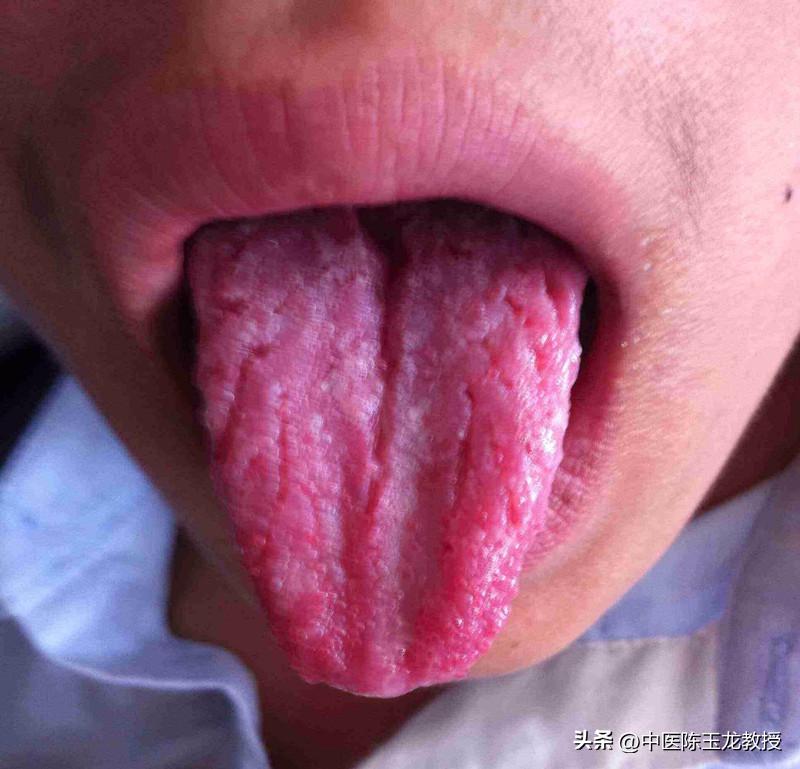 肾好百病消是真的吗,用什么中药泡水可以补肾阳