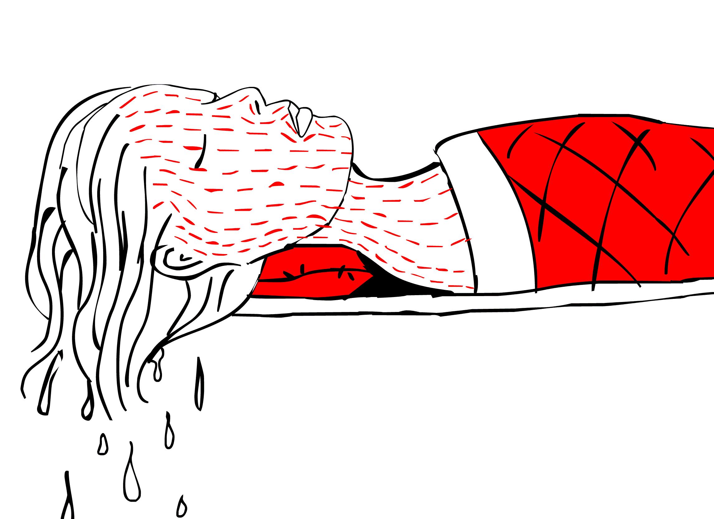 偏头痛偏爱女性,偏头痛的禁忌