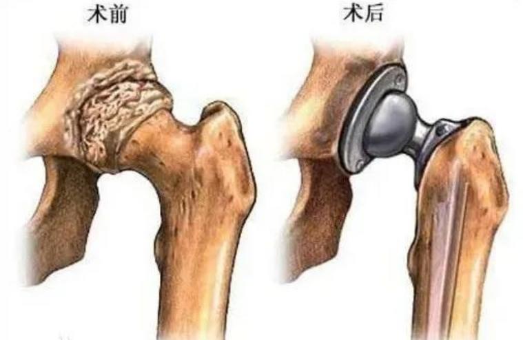 这些部位疼痛要小心冠心病,这些部位疼的原因你一定要知道