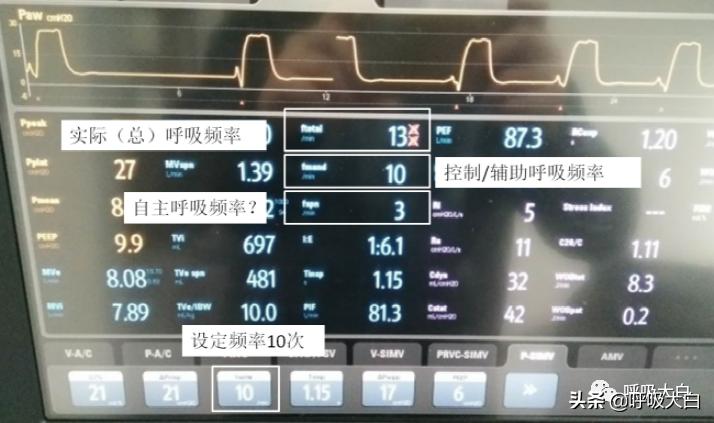 呼吸机设置：呼吸频率+吸呼比