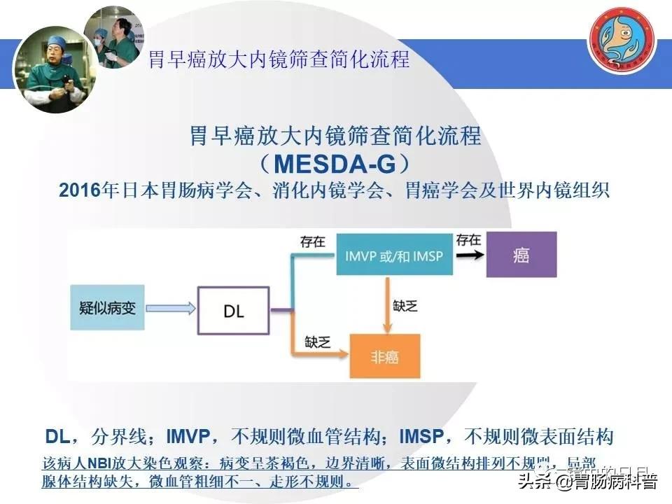 胃癌可以做内镜手术吗,早期胃癌内镜手术后追加外科手术