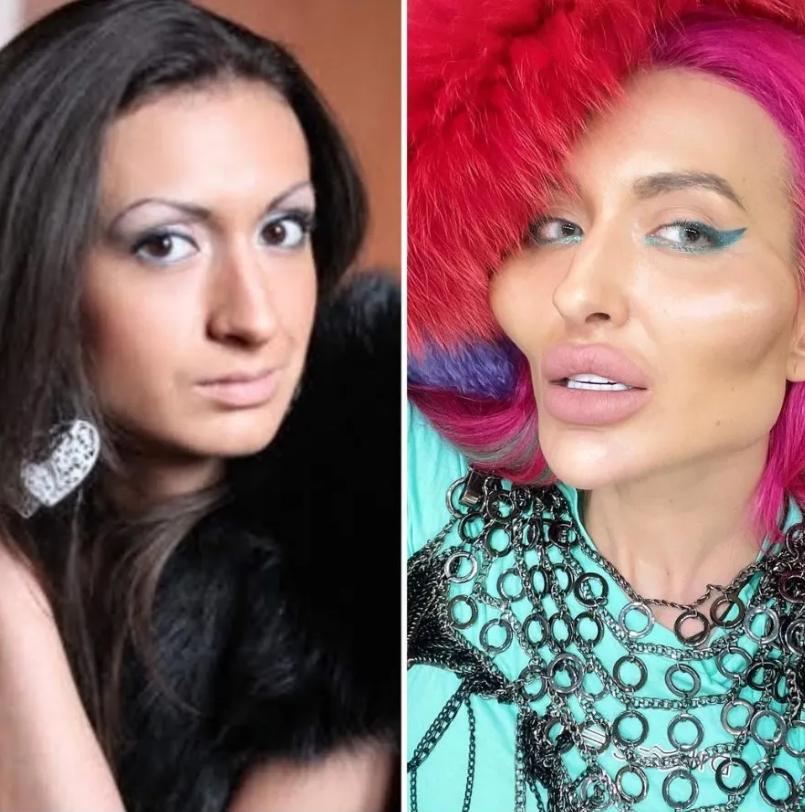 这个动手术打造世界最高颧骨的女人，再次向自己的颧骨下手了