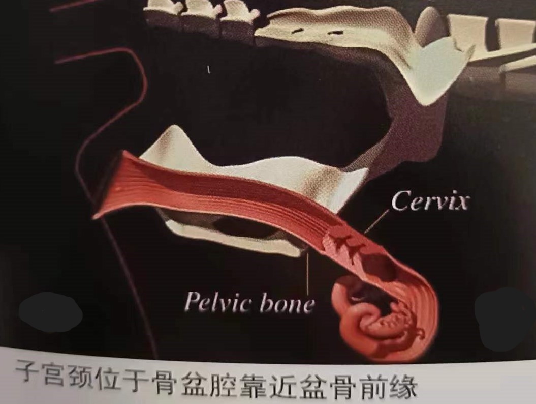 如何提高母牛同期的繁育能力,如何提高母牛受孕率