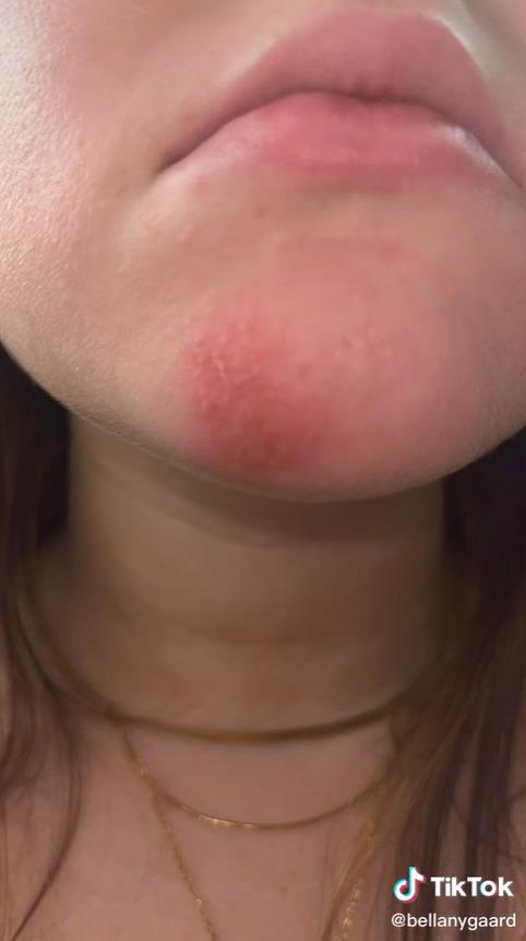 澳洲妹子和男友接吻,澳大利亚女子与男友接吻