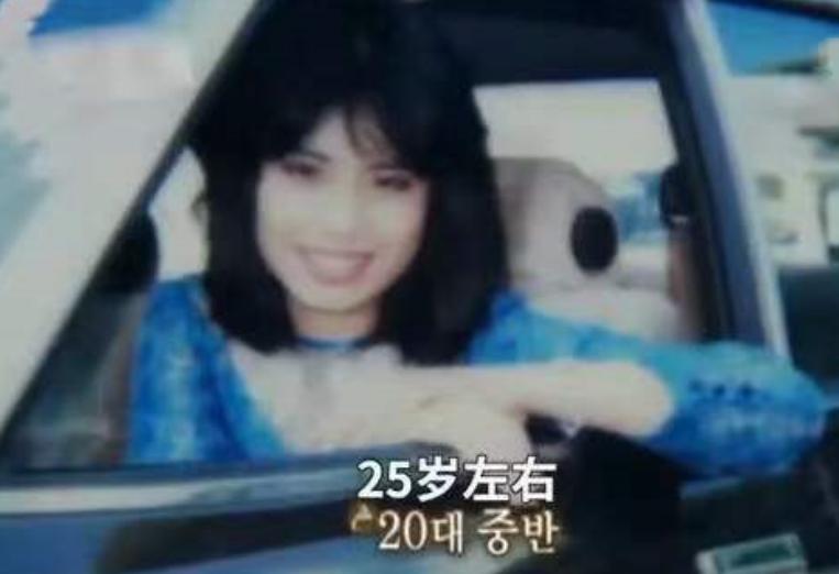 韩慧景整容是打了玻尿酸了吗,韩慧景整容案例