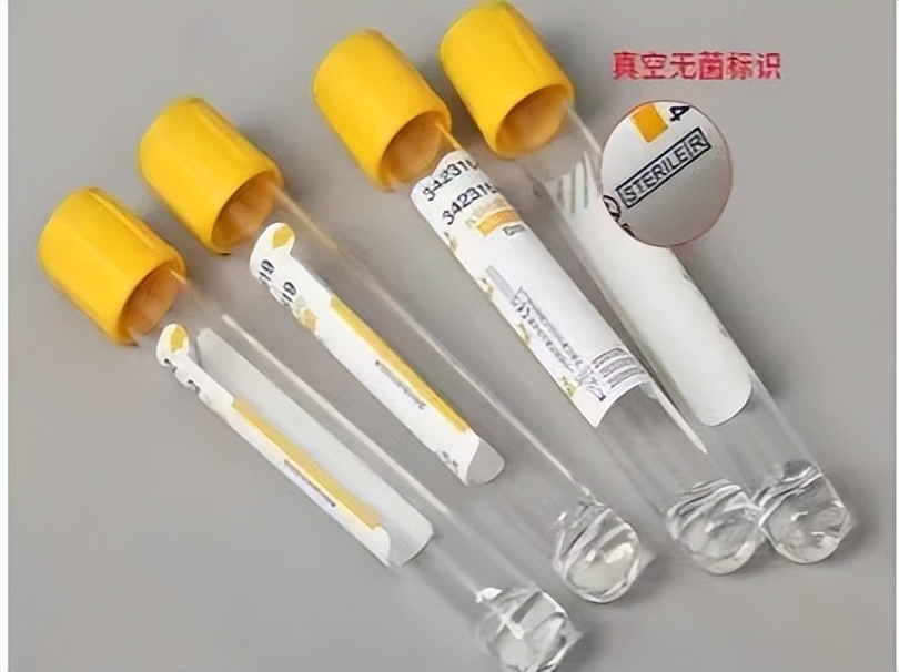 每年体检查血应该查哪些方面,体检生化免疫检查结果什么意思