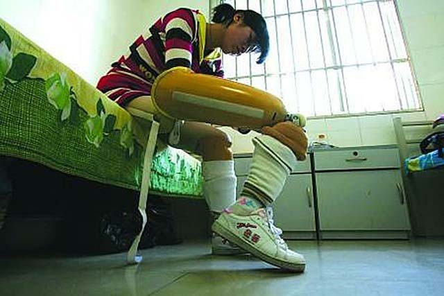 小腿巨粗的女孩,河南女子患病腿粗如大象