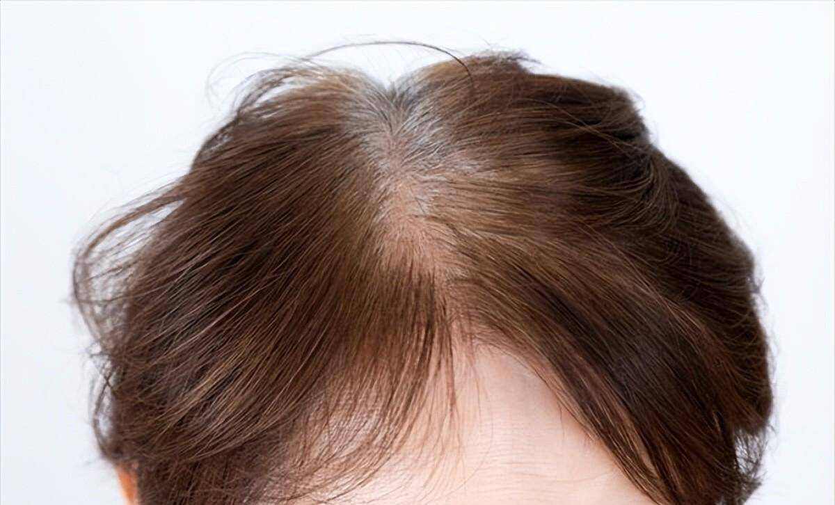 头发的长短稀疏决定衰老的速度,头发稀少又白让人一下子老了几岁