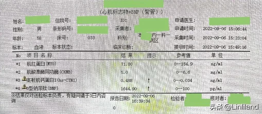 过速性房颤治疗,持续性房颤心动过速